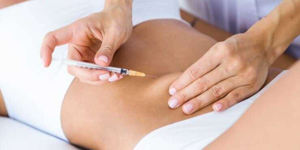 Contours Redefined: Experience Fat Cavitation Locally